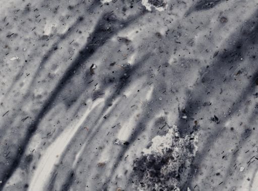 Entamoeba histolytica