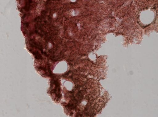 Plakortis sp.