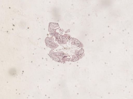 Blatta orientalis