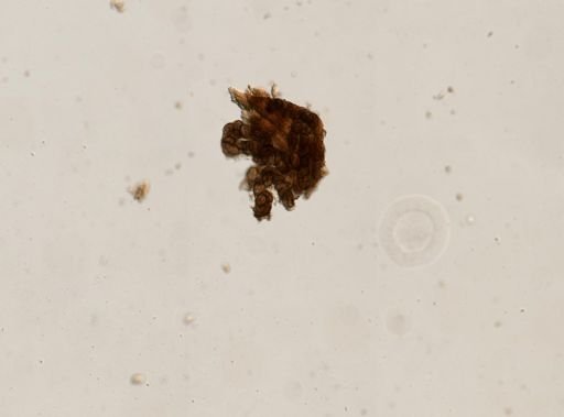 Diphyllobothrium canis