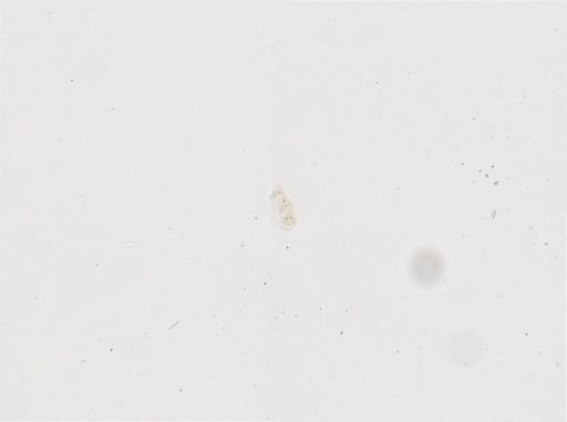 Paramecium