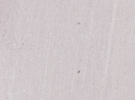 Plasmodium falciparum