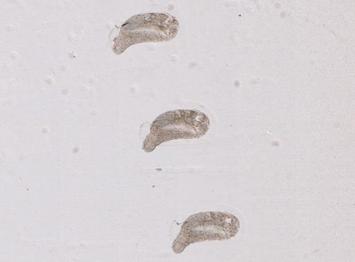 Paravortex gemellipara