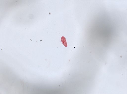 Paramecium aurelia