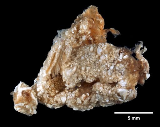 Distoma convexum