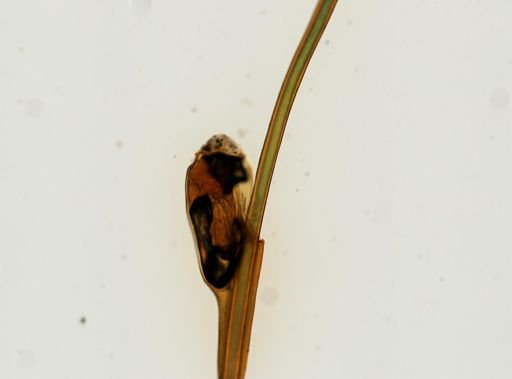 Pthirus pubis