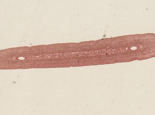 Taenia taeniaeformis