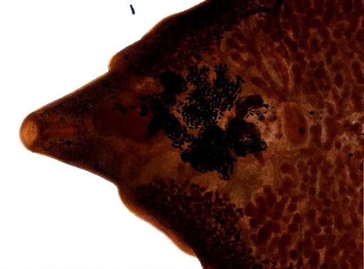 Fasciola hepatica