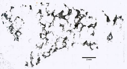 Fibularia massa