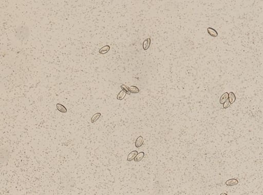 Enterobius vermicularis