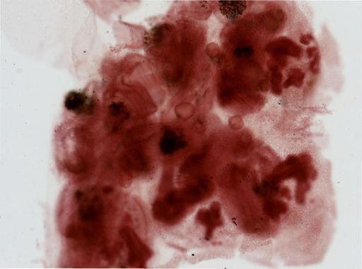 Pectinatella magnifica