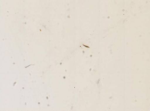Paramecium