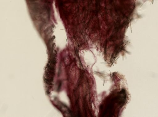 Tedania suctoria