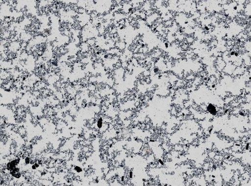 Giardia lamblia