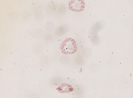 Blattella germanica