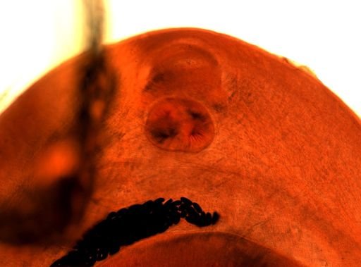 Fasciolopsis buski