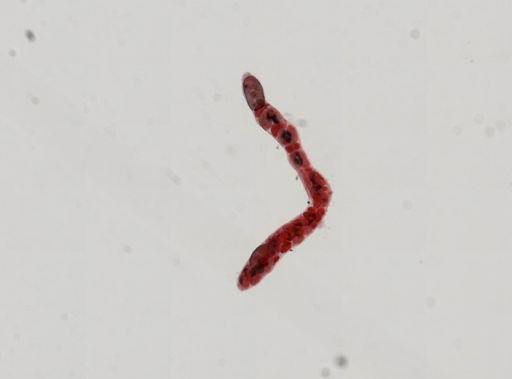 Trematoda