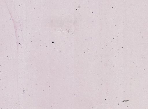 Plasmodium ovale