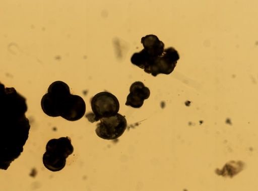 Orbulina