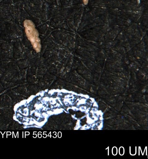 Verneuilina canadensis