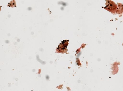 Clonorchis sinensis