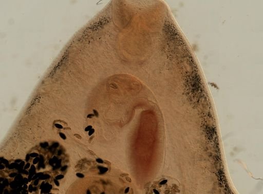 Fasciola hepatica