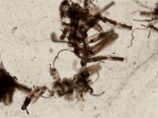 Bryozoa