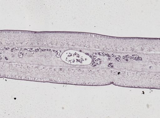Taenia saginata