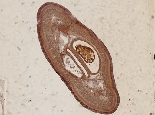 Amphiporus formidabilis