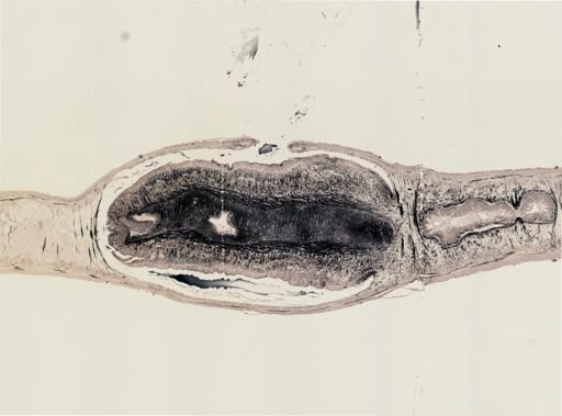 Turbellaria