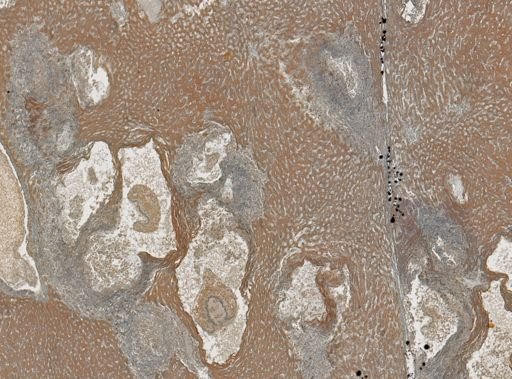 Taenia crassicollis