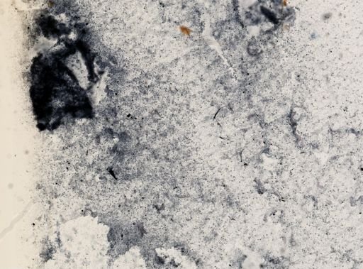 Trichomonas wenrichi