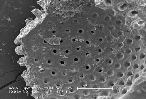 Globigerinoides sacculifer
