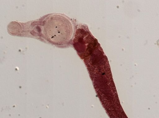 Gorgoderina
