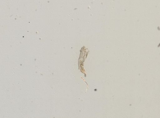 Somatogyrus depressus