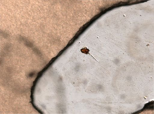 Trichocerca multicrinis