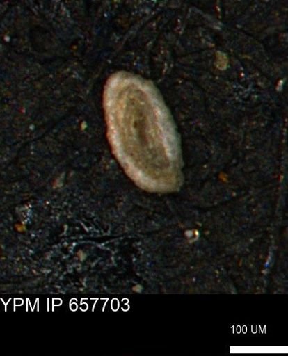 Spirolocammina subcircularis
