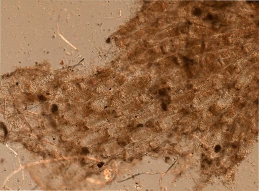 Bryozoa