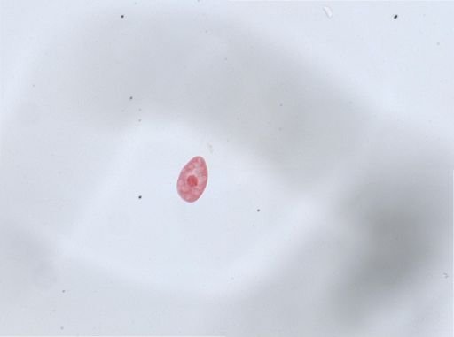Paramecium aurelia