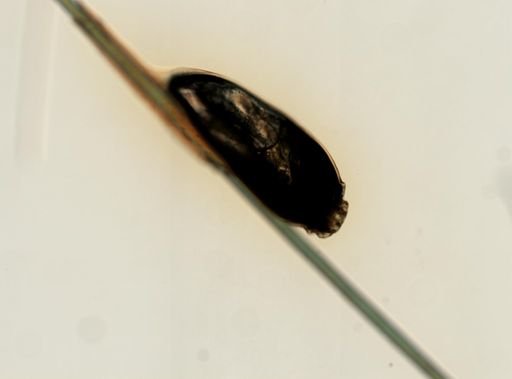 Pediculus humanus