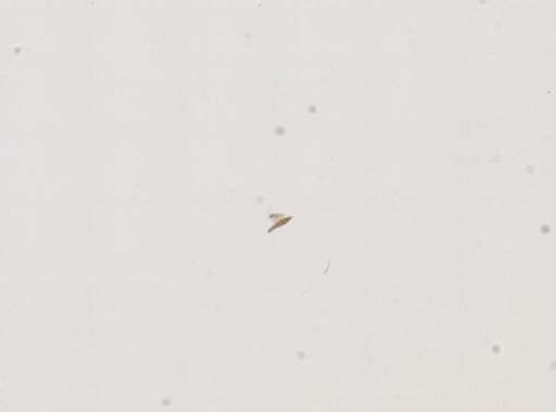 Paramecium