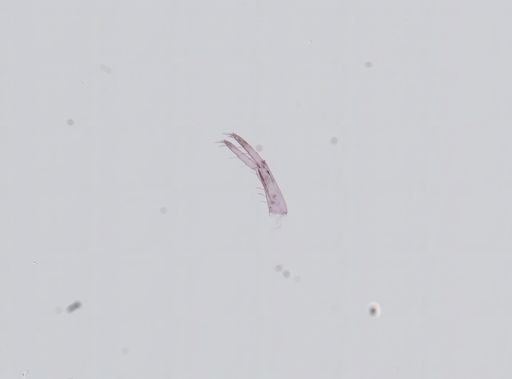 Hyalella cf. azteca