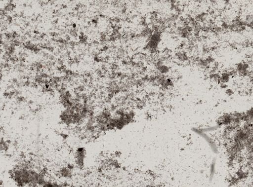 Iodamoeba butschlii