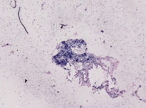 Toxoplasma