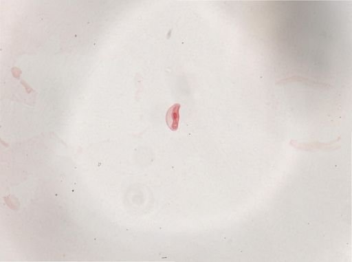 Paramecium