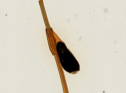 Pthirus pubis