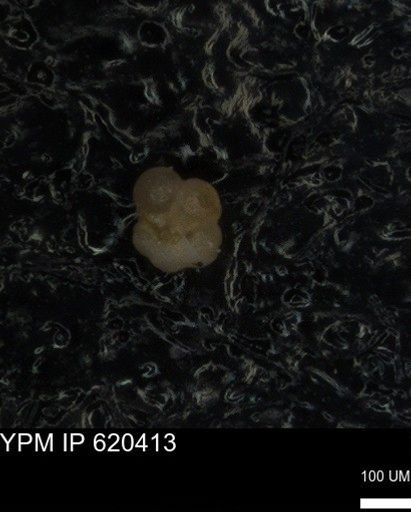undet. Rugoglobigerinidae