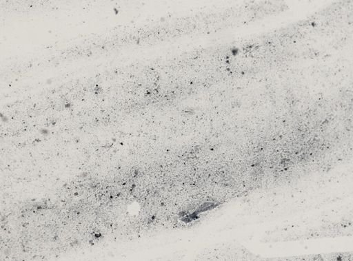 Entamoeba histolytica