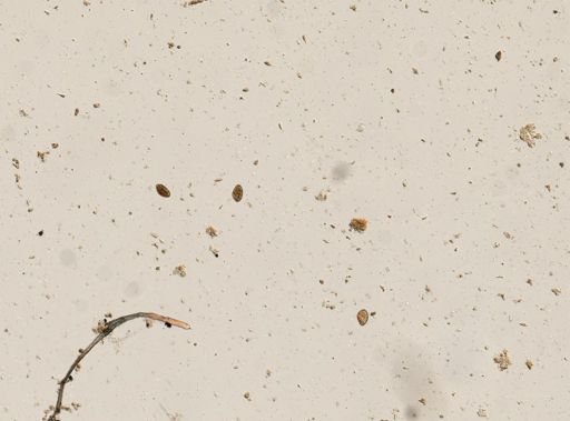 Diphyllobothrium canis