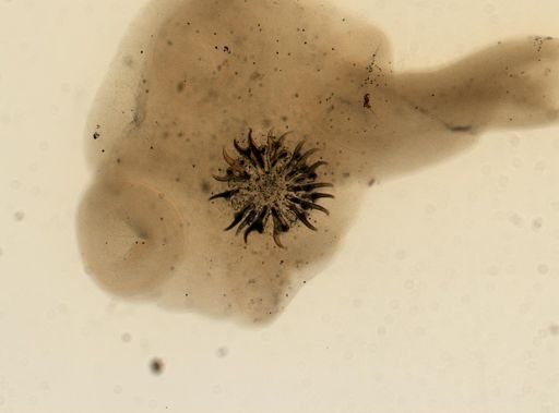 Taenia solium